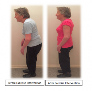 exercise-intervention-before-after